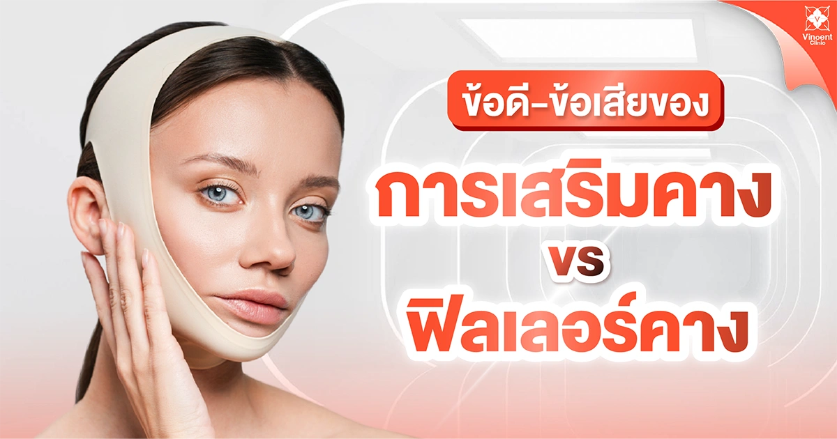 ข้อดี ข้อเสีย การเสริมคางและฟิลเลอร์คาง