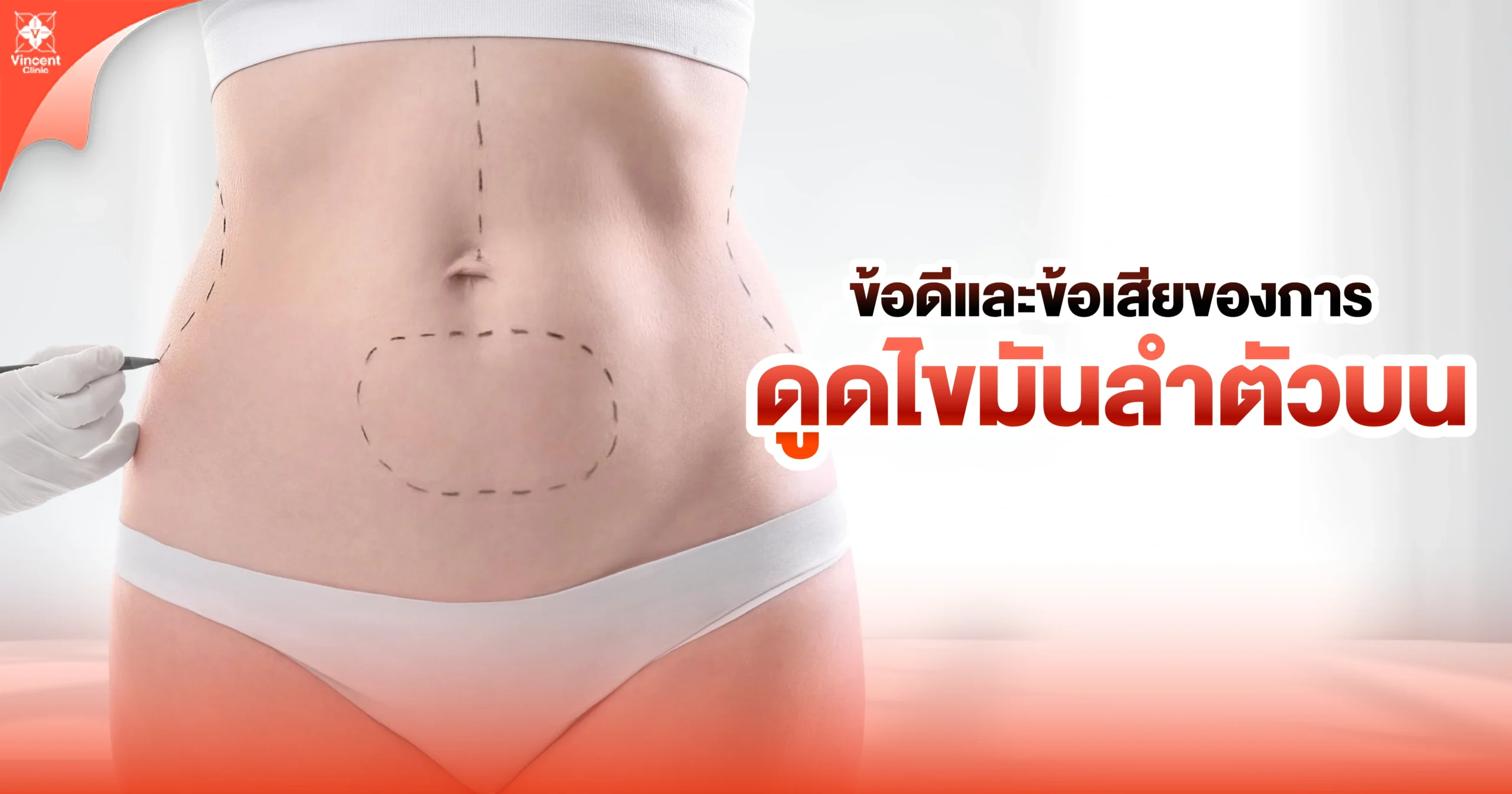ข้อดีข้อเสียของการดูดไขมันลำตัวบน