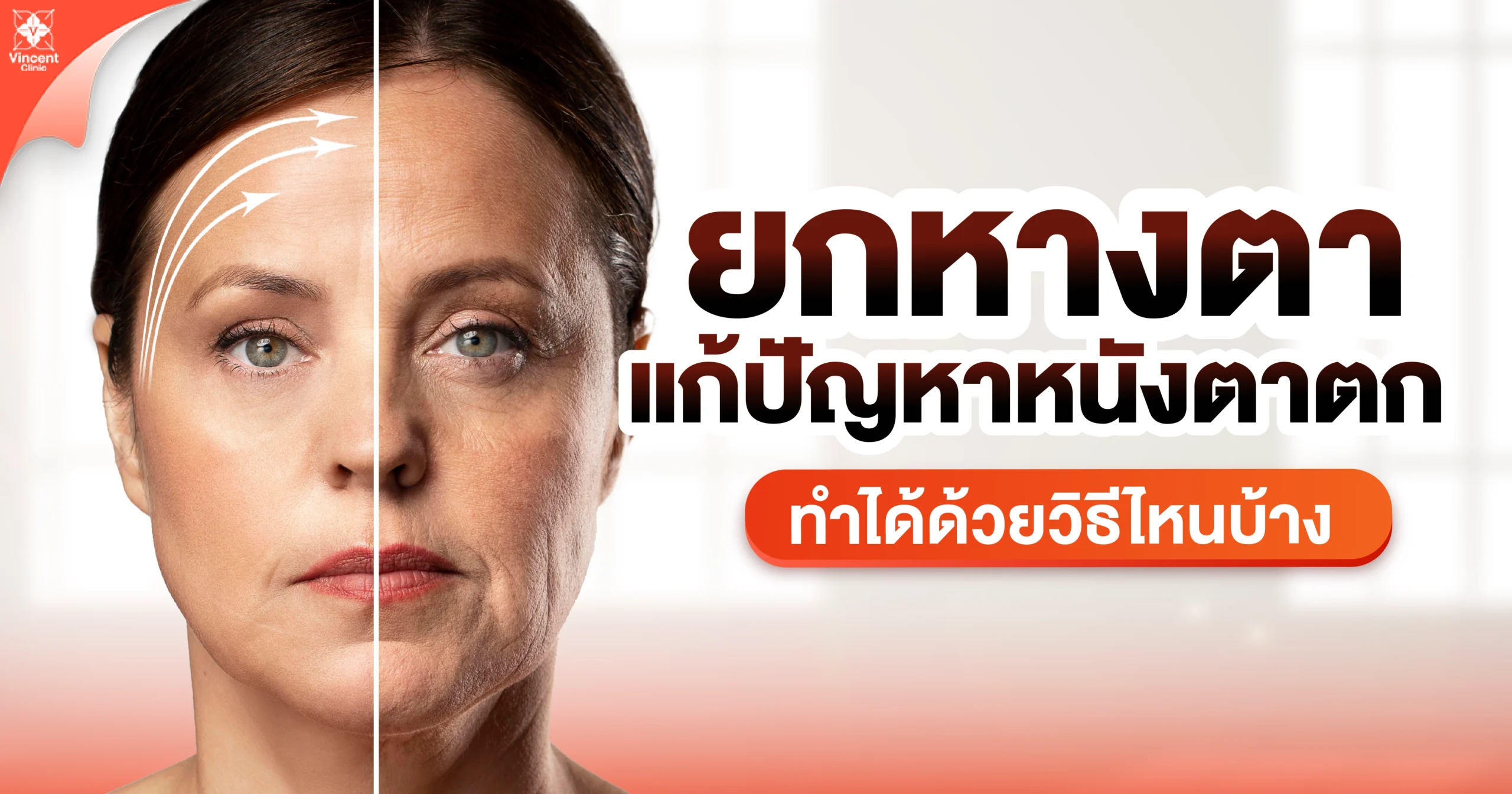 ยกหางตาแก้ปัญหาหนังตาตก