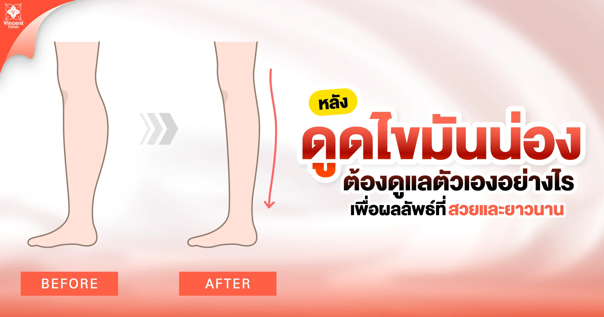 หลังดูดไขมันน่องควรดูแลตัวเองยังไง