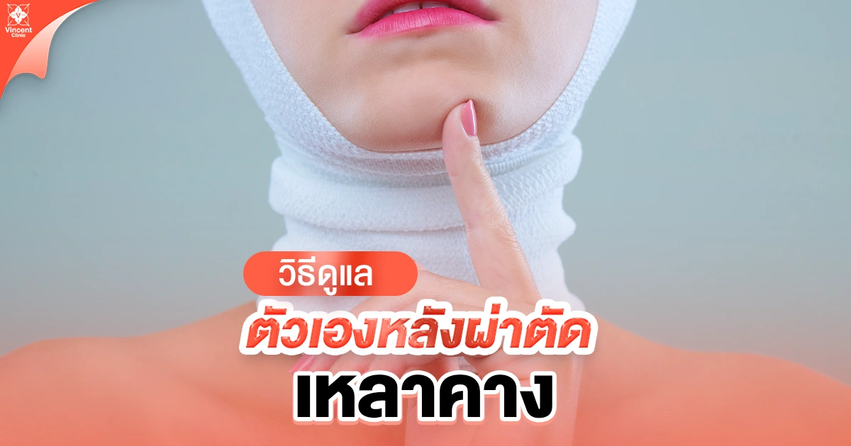 วิธีดูแลตัวเองหลังผ่าตัดเหลาคาง