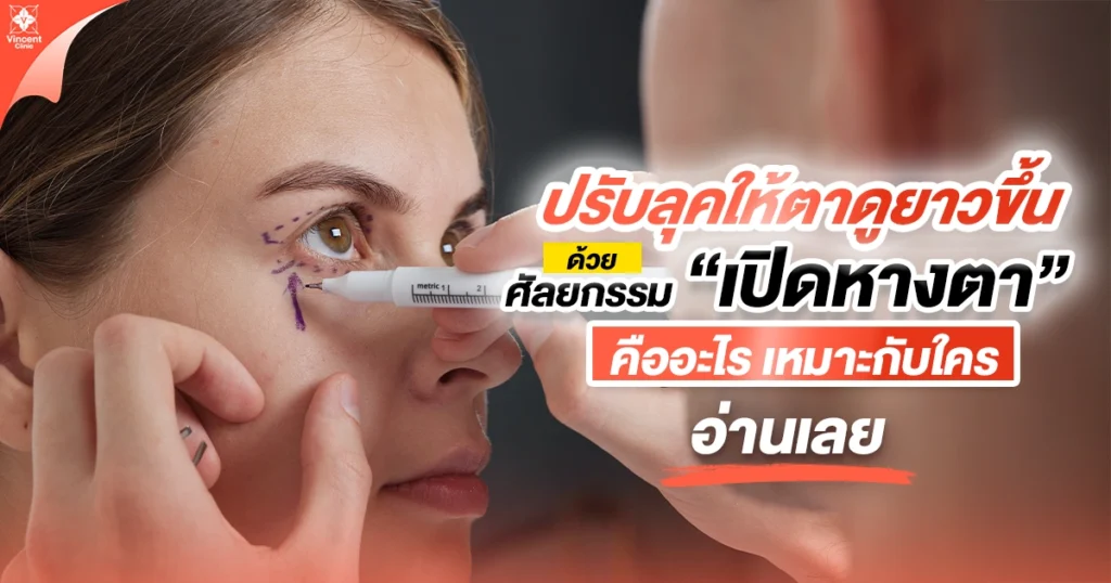 ศัลยกรรมเปิดหางตา