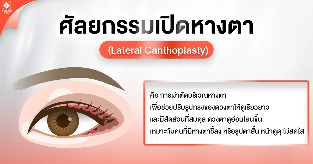 ศัลยกรรมเปิดหางตา คืออะไร เหมาะกับใคร