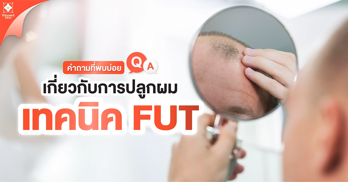 คำถามเกี่ยวกับการปลูกผมเทคนิค FUT