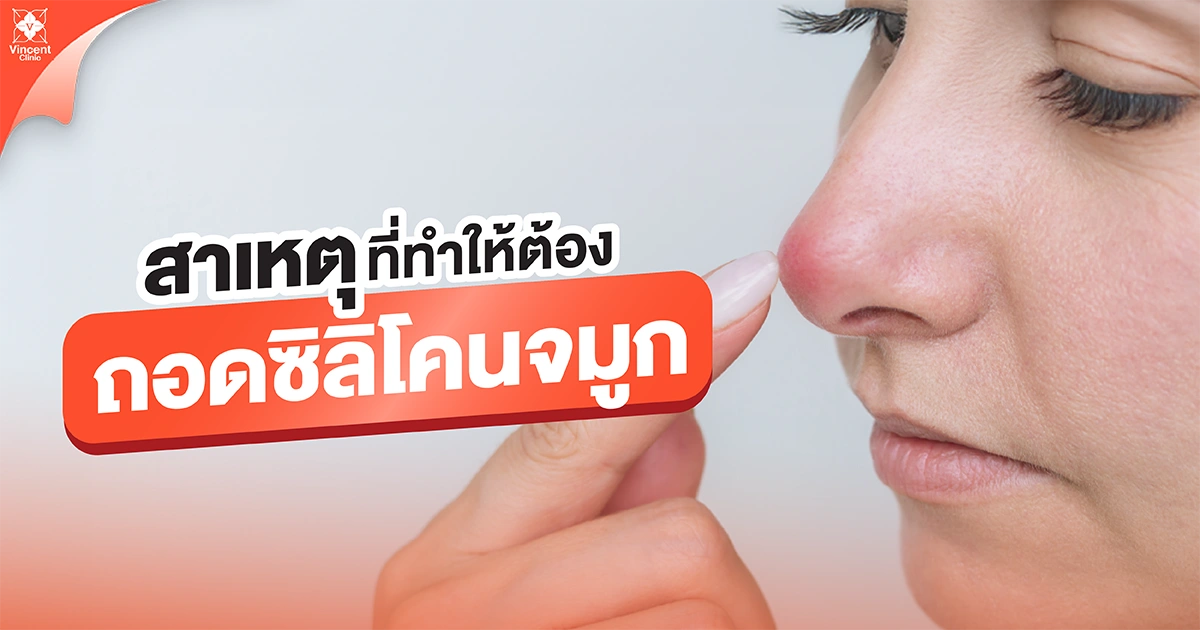 สาเหตุที่ทำให้ต้องถอดซิลิโคนจมูก