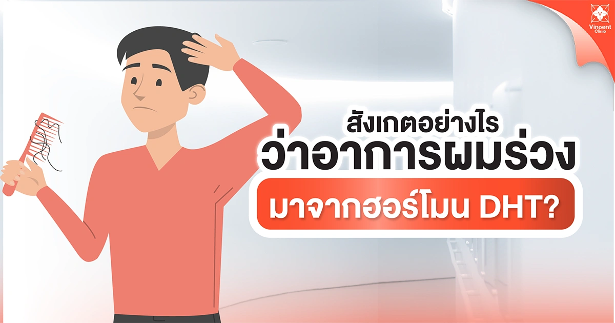 สังเกตอาการผมร่วงที่มาจากฮอร์โมน DHT