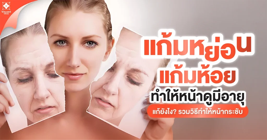 แก้มหย่อน แกเมห้อย ทำให้หน้าดูมีอายุ แก้ยังไง