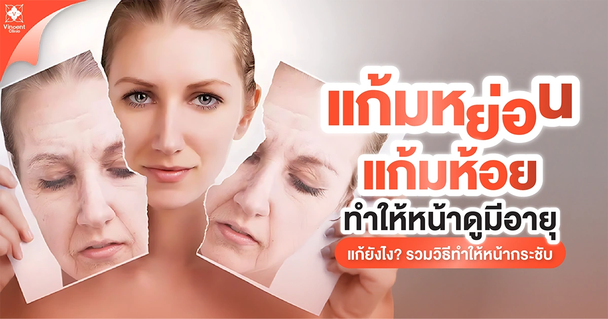 แก้มหย่อน แกเมห้อย ทำให้หน้าดูมีอายุ แก้ยังไง
