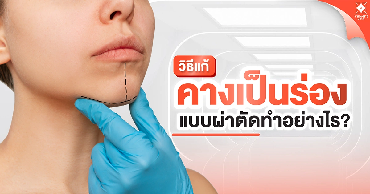 วิธีแก้คางเป็นร่องแบบผ่าตัด