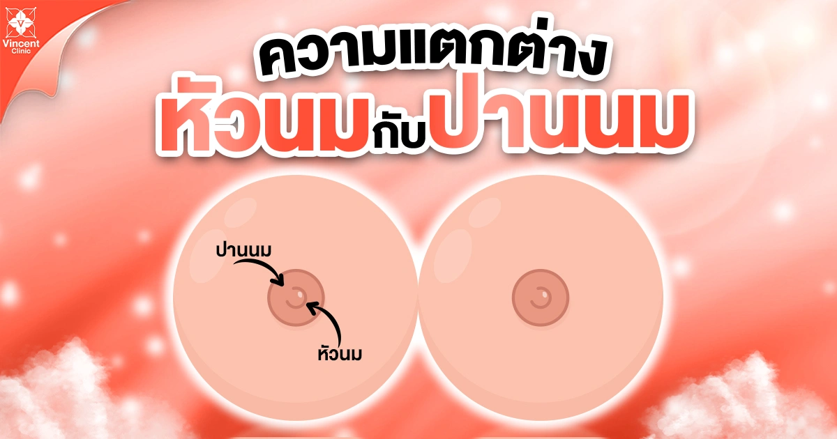 ความแตกต่างหัวนมกับปานนม