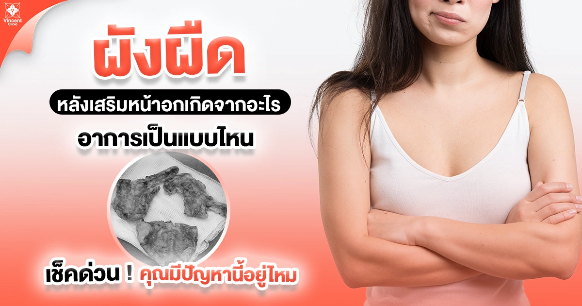 ผังผืดหลังเสริมหน้าอกเกิดจากอะไร