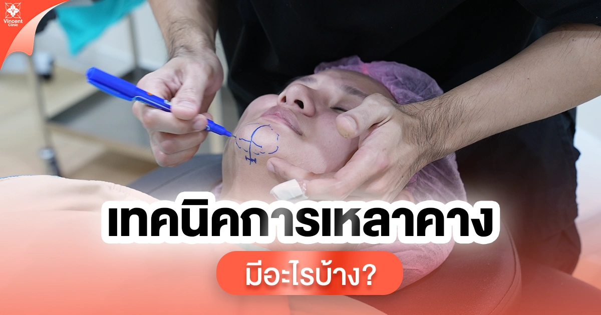 เทคนิคการเหลาคางมีอะไรบ้าง?