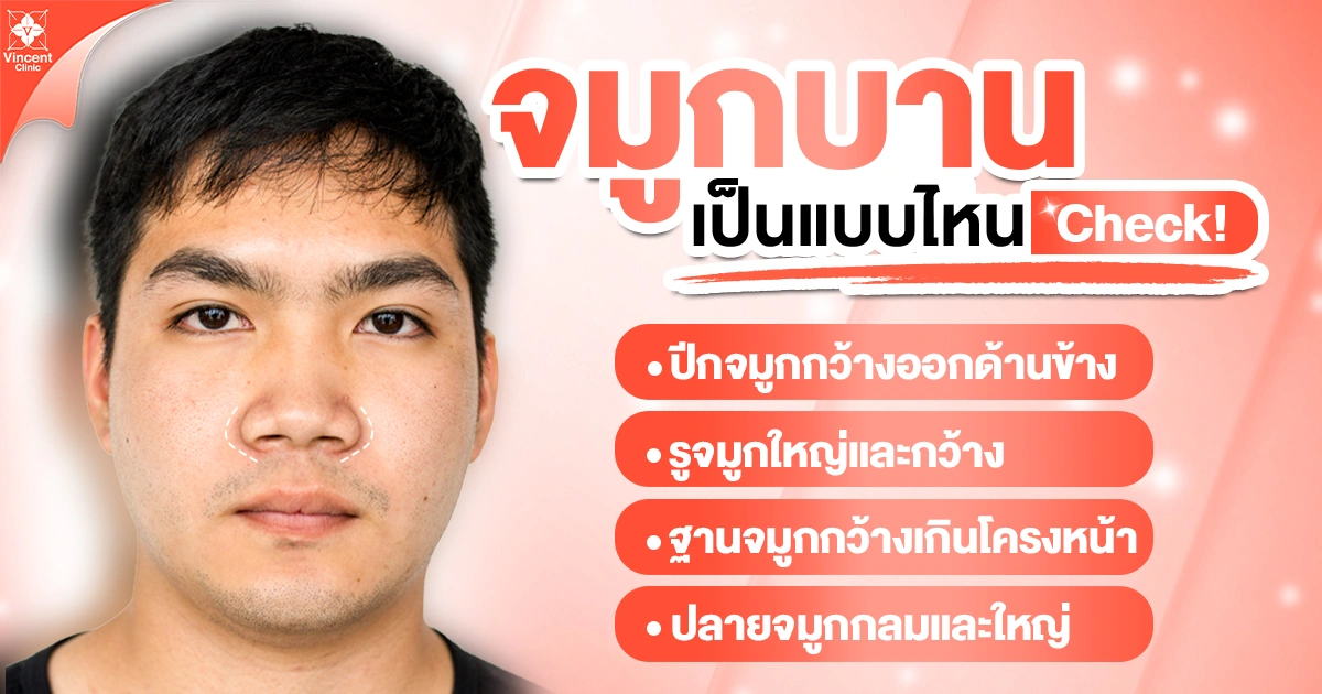 จมูกบานเป็นแบบไหน