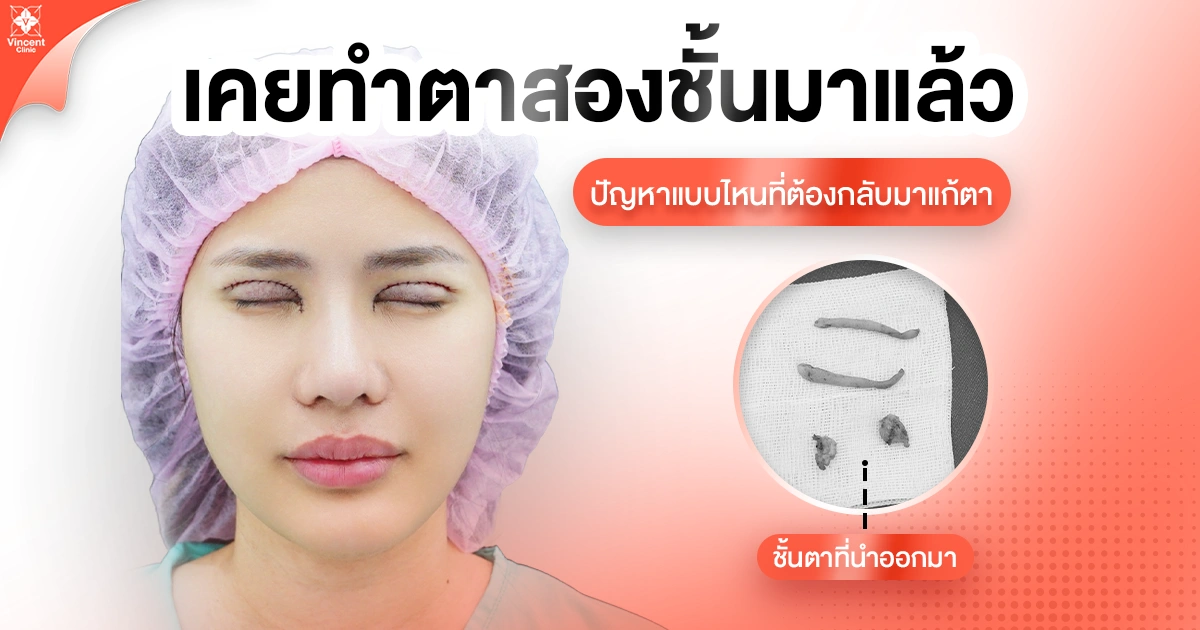 แก้ตาสองชั้นต้องรอนานแค่ไหน