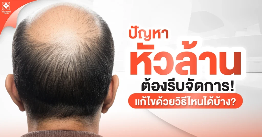 What methods can be used to solve the problem of baldness
