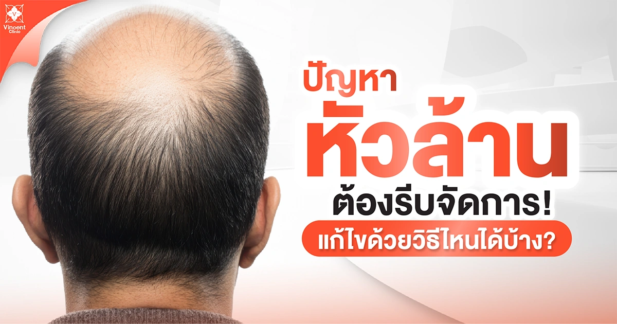 What methods can be used to solve the problem of baldness