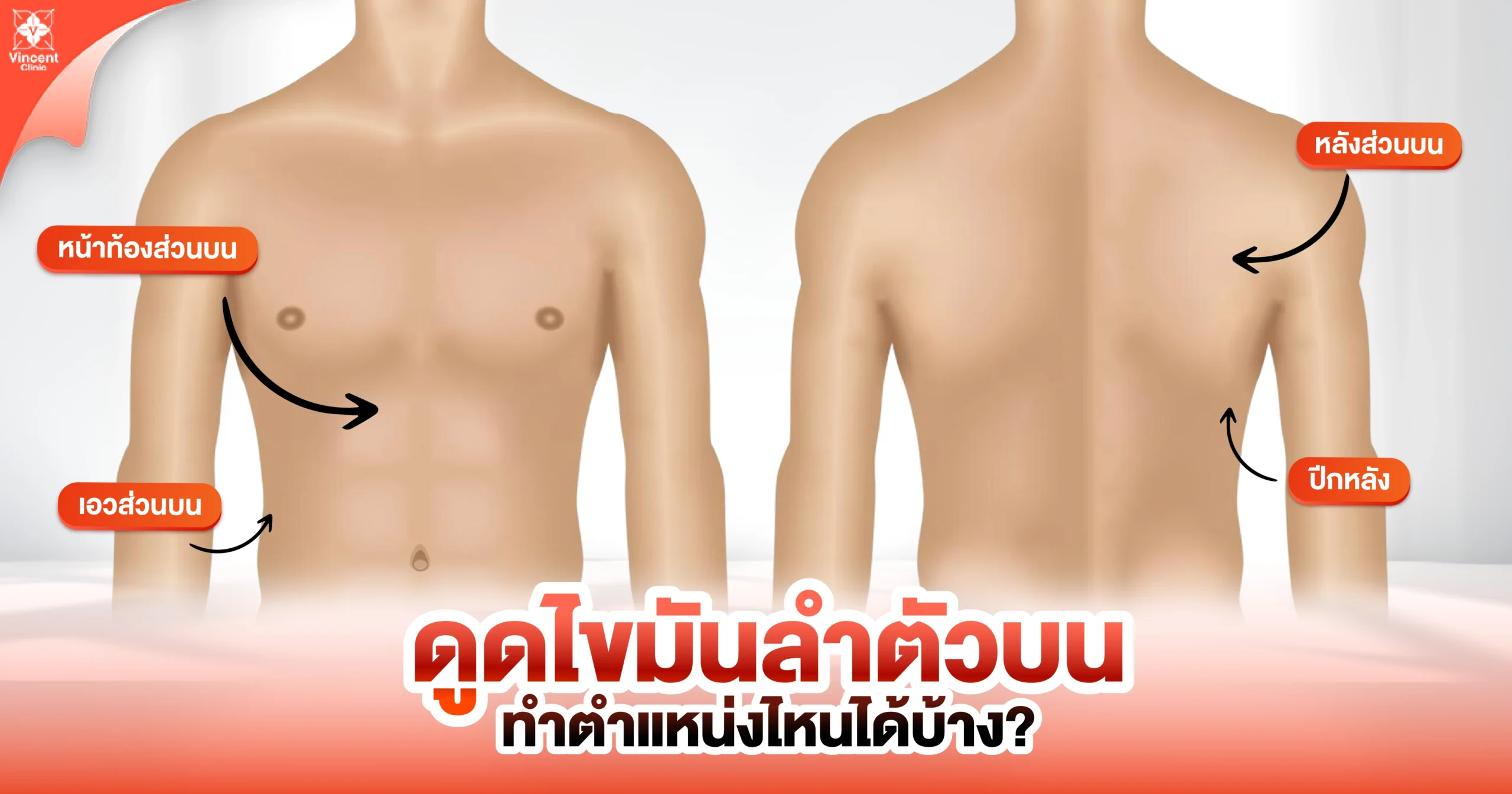 ดูดไขมันลำตัวบนทำตำแหน่งไหนได้บ้าง