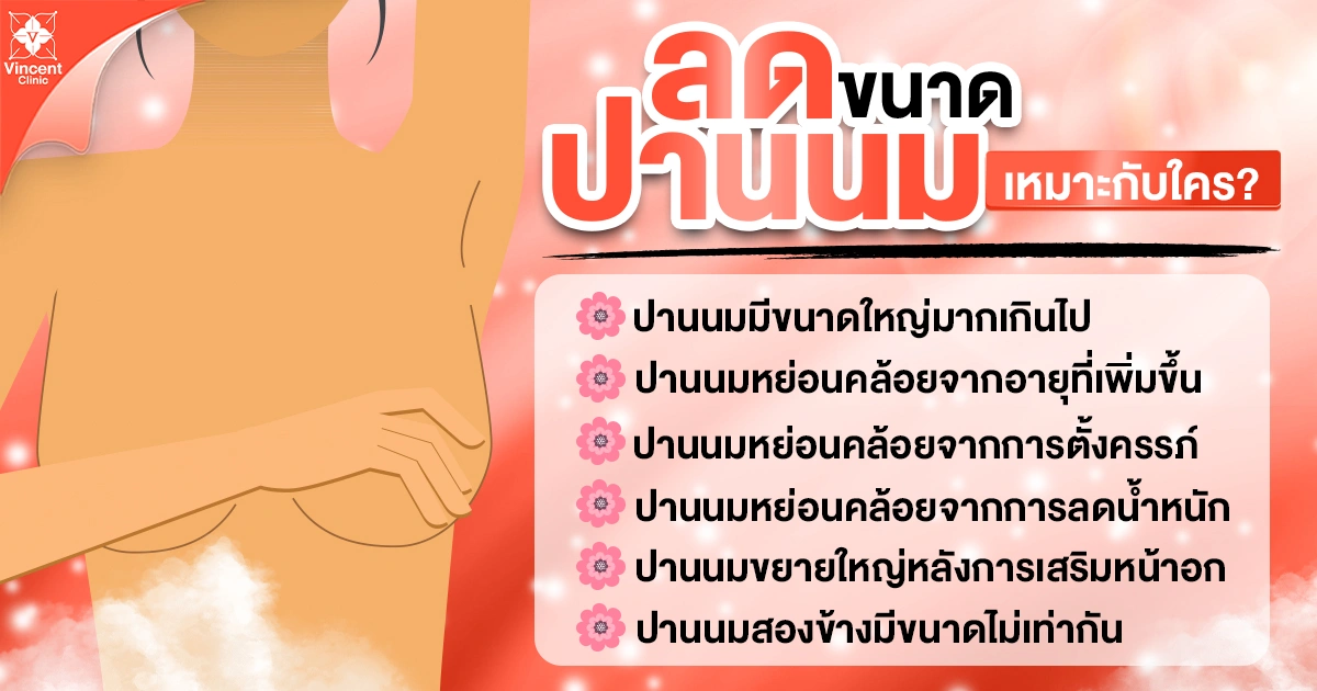 ลดขนาดปานนมเหมาะกับใคร?