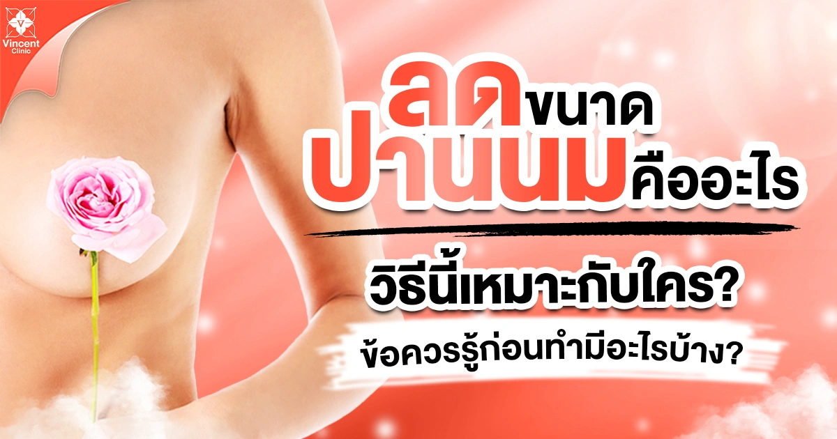 ลดขนาดปานนมคืออะไร? วิธีนี้เหมาะกับใคร? ข้อควรรู้ก่อนทำมีอะไรบ้าง?