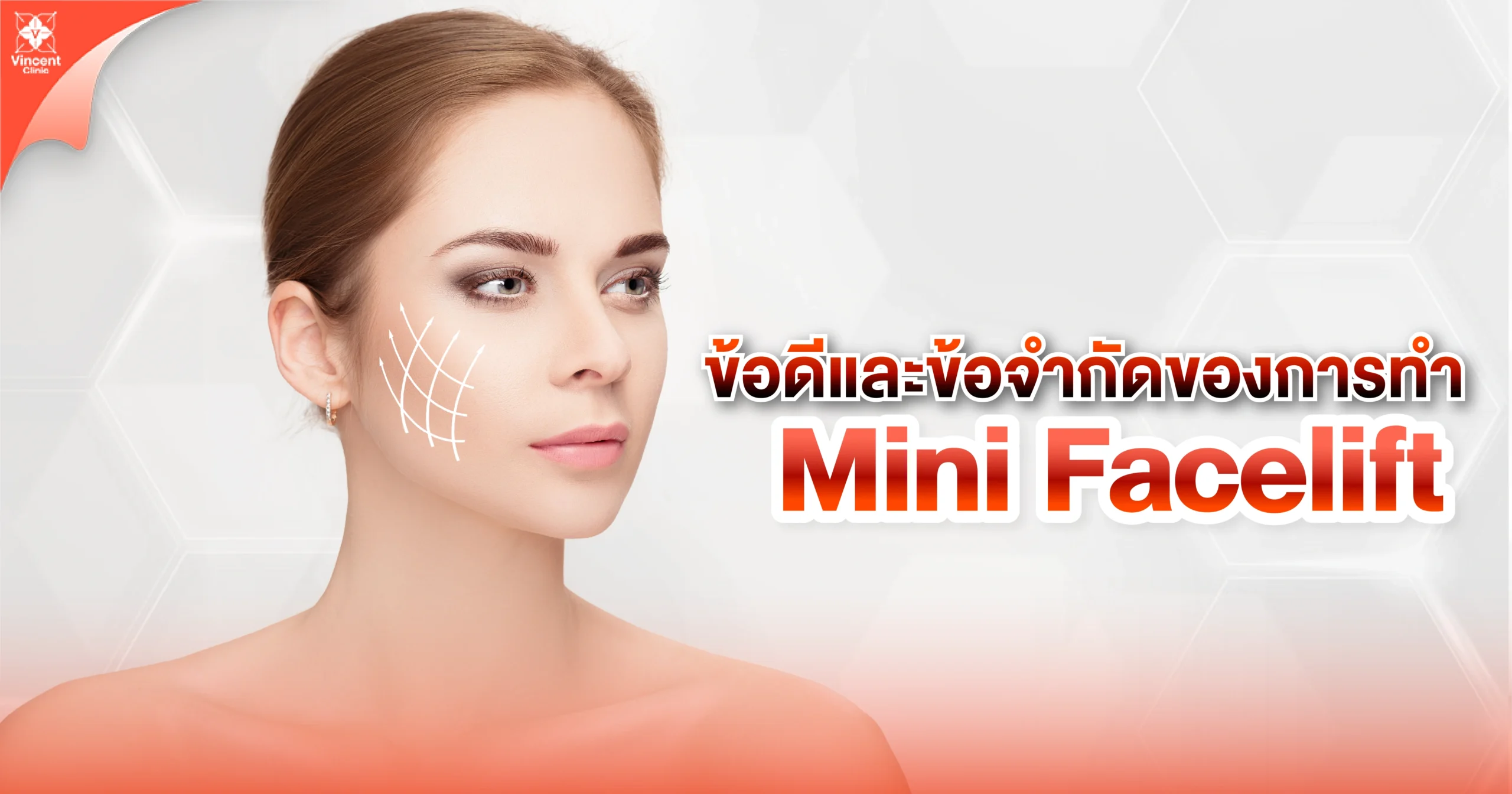 ข้อดีและข้อจำกัดของการทำ mini facelift