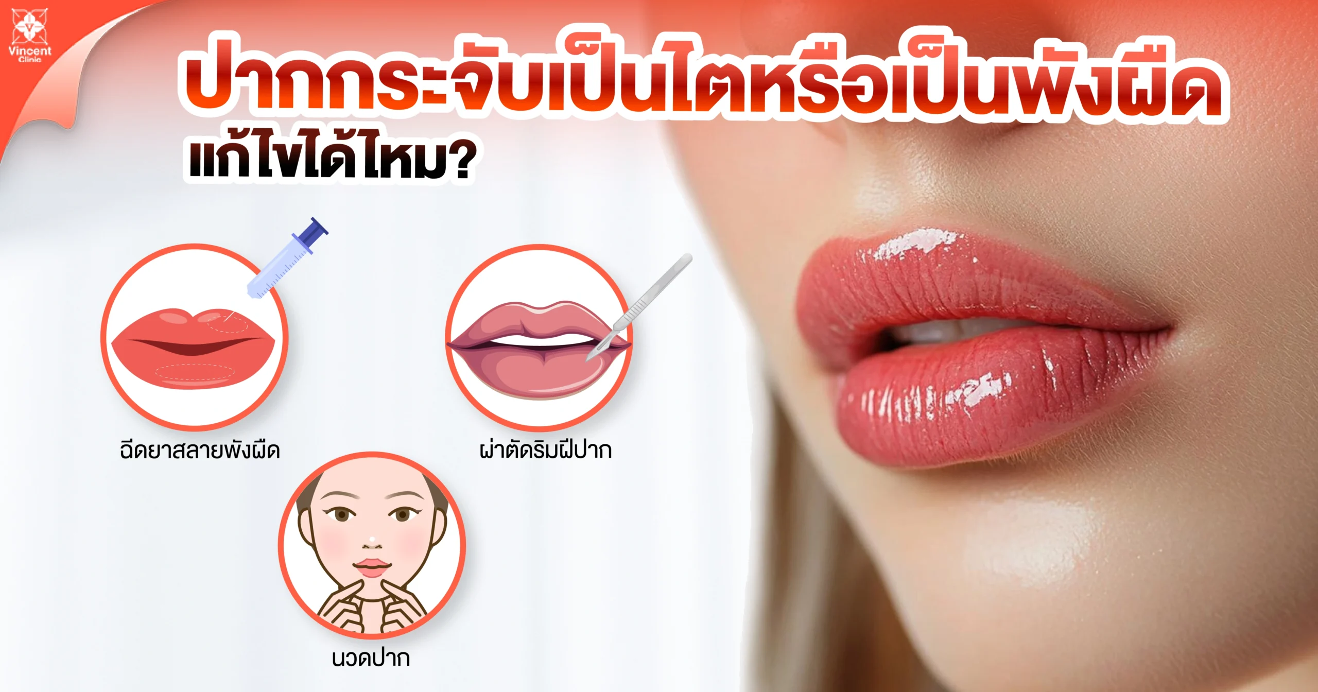 ปากกระจับคลายตัวหรือเป็นพังผืดแก้ไขได้ไหม