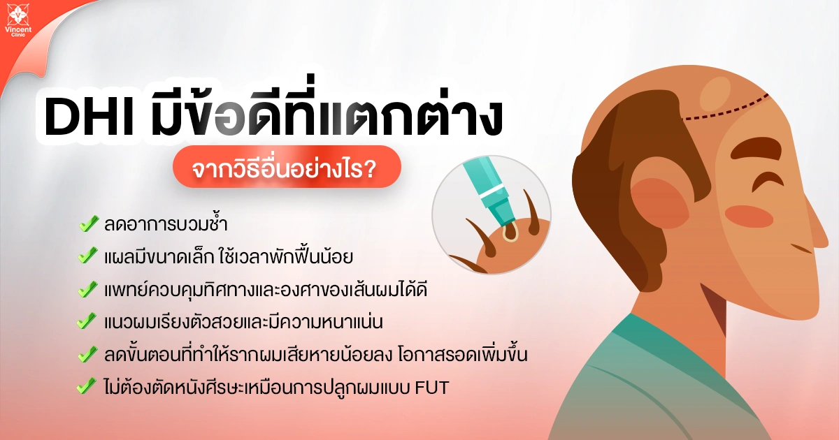 dhi มีข้อดีที่แตกต่างจากวิธีอื่นยังไง