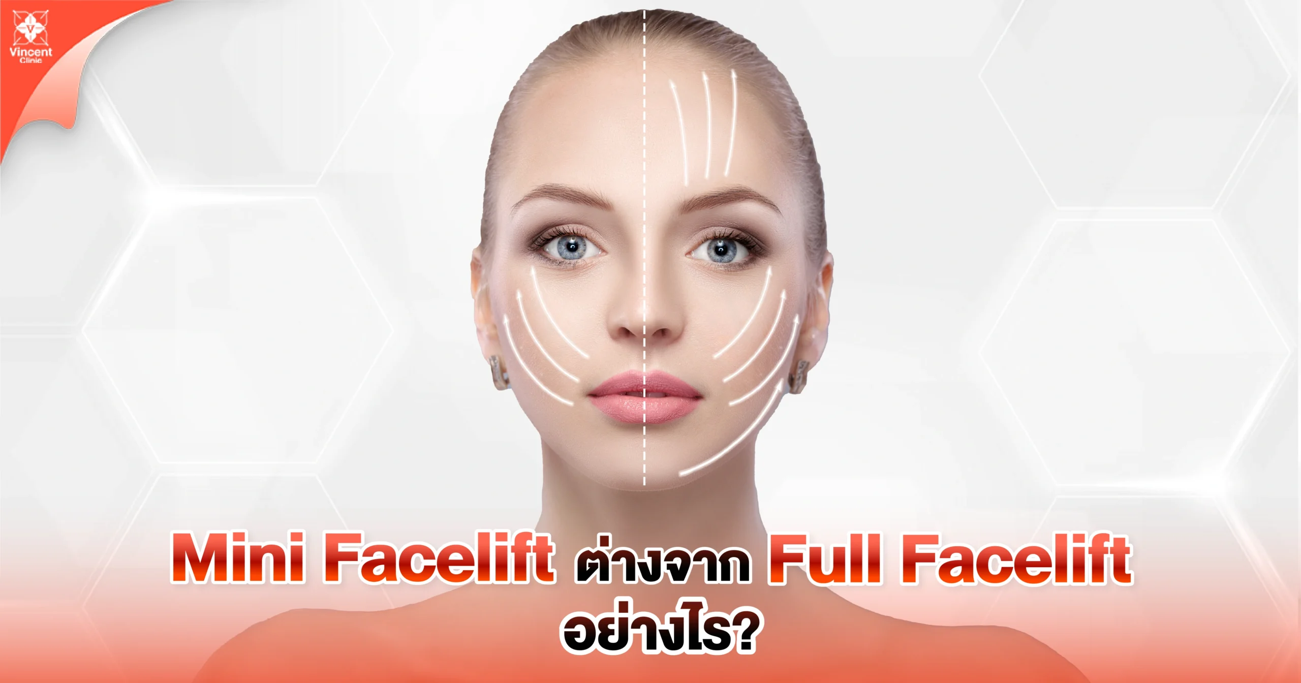 mini faceift ต่างจาก full facelift อย่างไร
