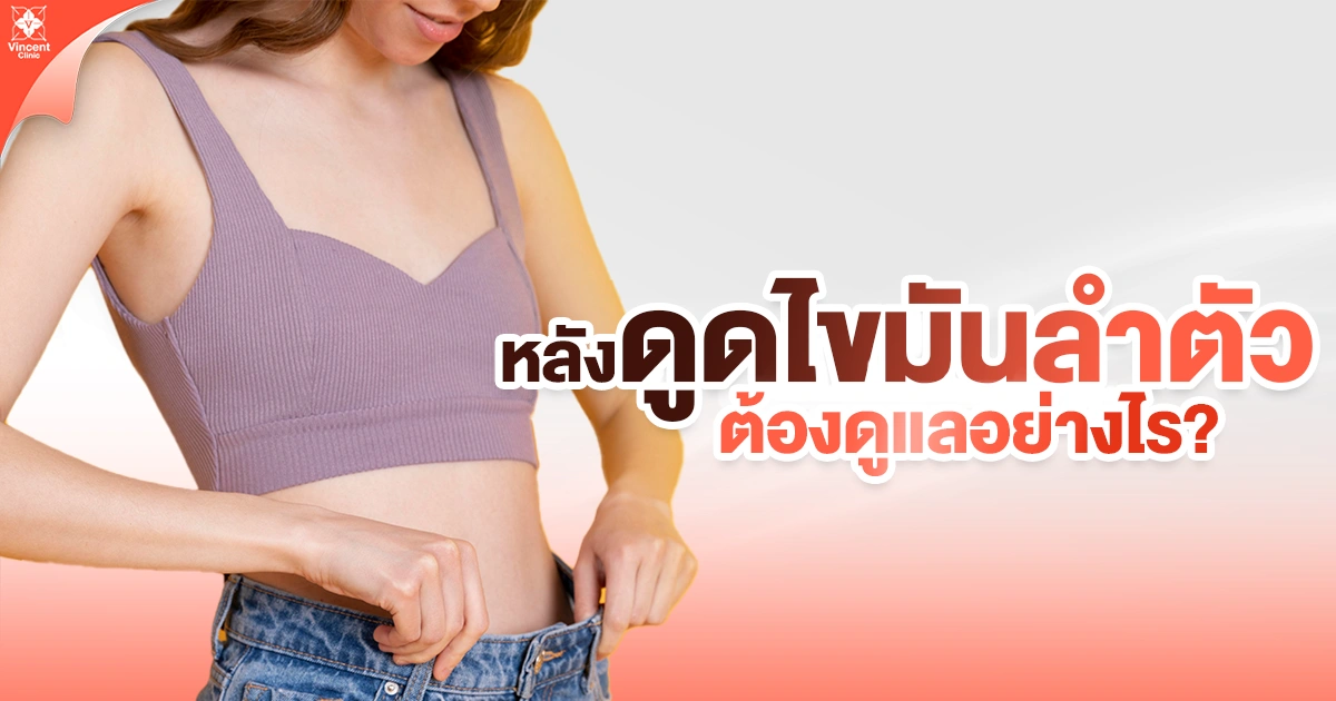 หลังดูดไขมันลำตัว ต้องดูแลอย่างไร