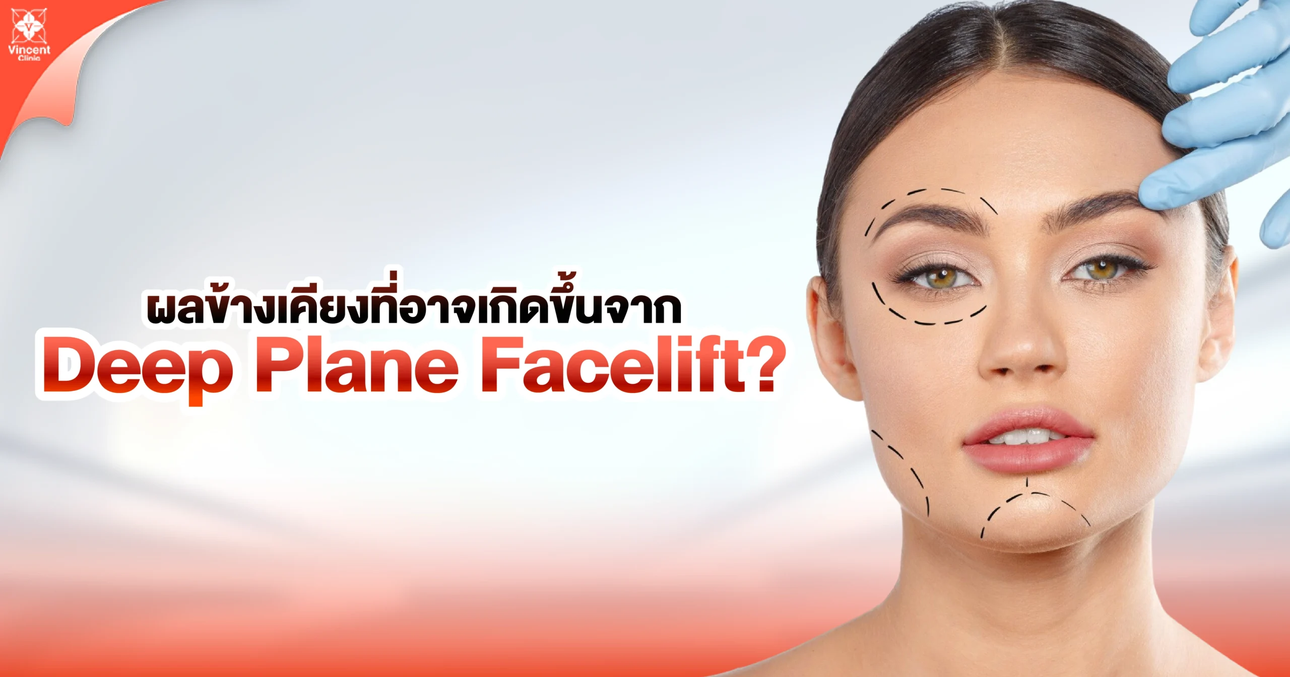 ผลข้างเคียงที่อาจเกิดขึ้นจาก deep plane Facelift
