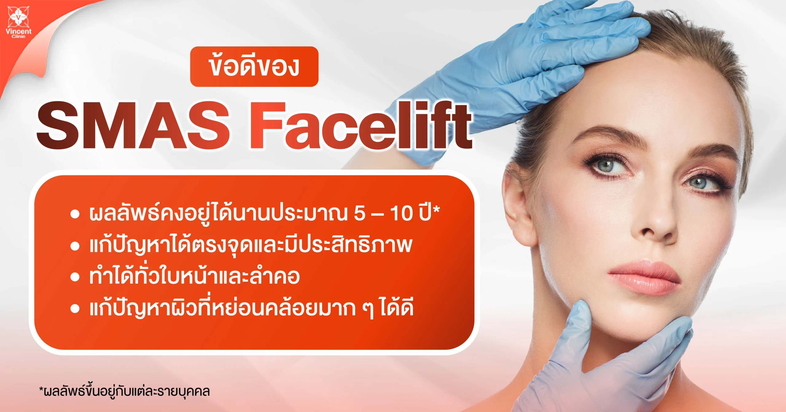 ข้อดีของ SMAS Facelift
