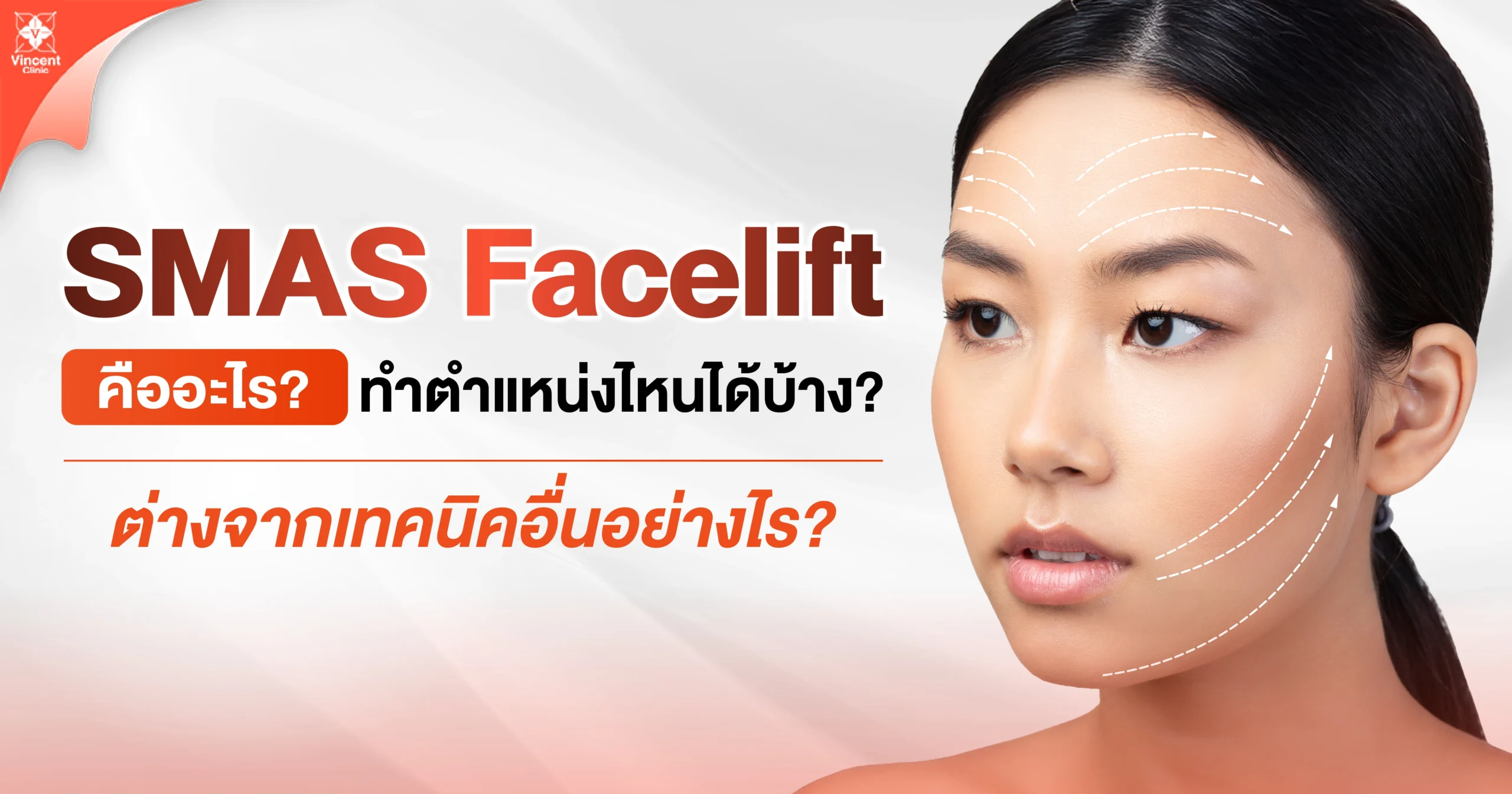 SMAS Facelift คืออะไร? ทำตำแหน่งไหนได้บ้าง? ต่างจากเทคนิคอื่นอย่างไร?