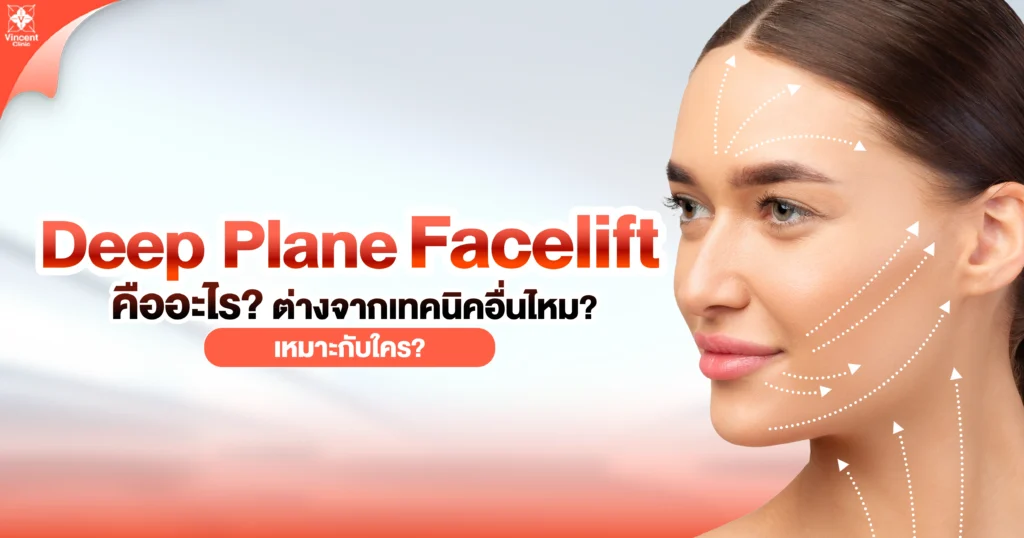 deep plane Facelift คืออะไร