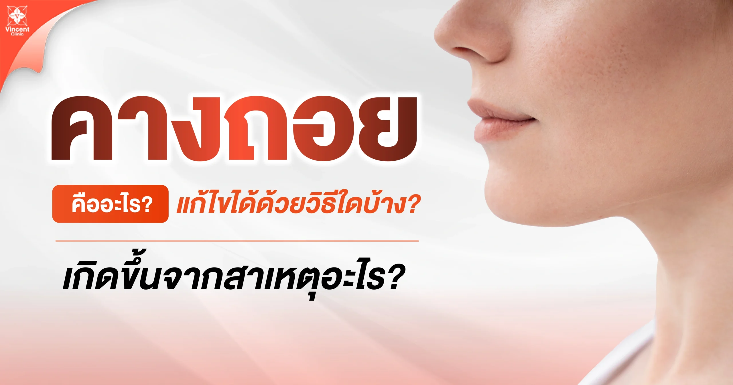 คางถอยคืออะไร