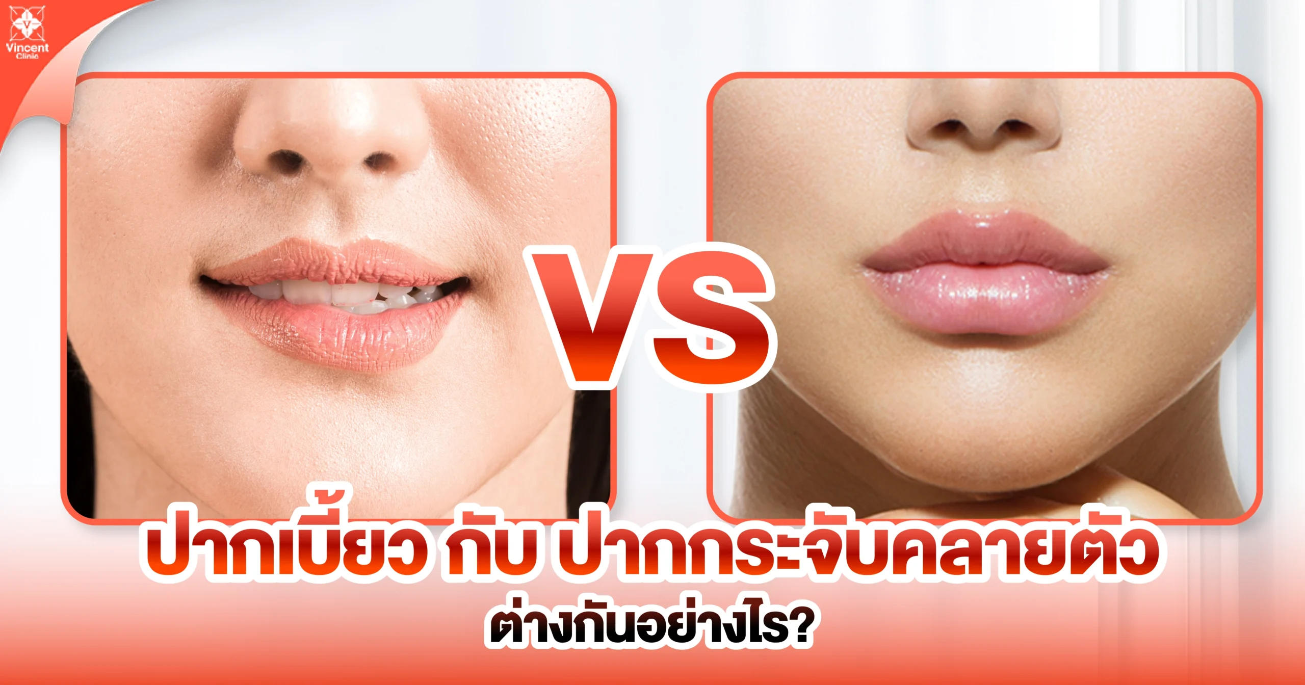 ปากเบี้ยว กับปากกระจับคลายตัวต่างกันอย่างไร