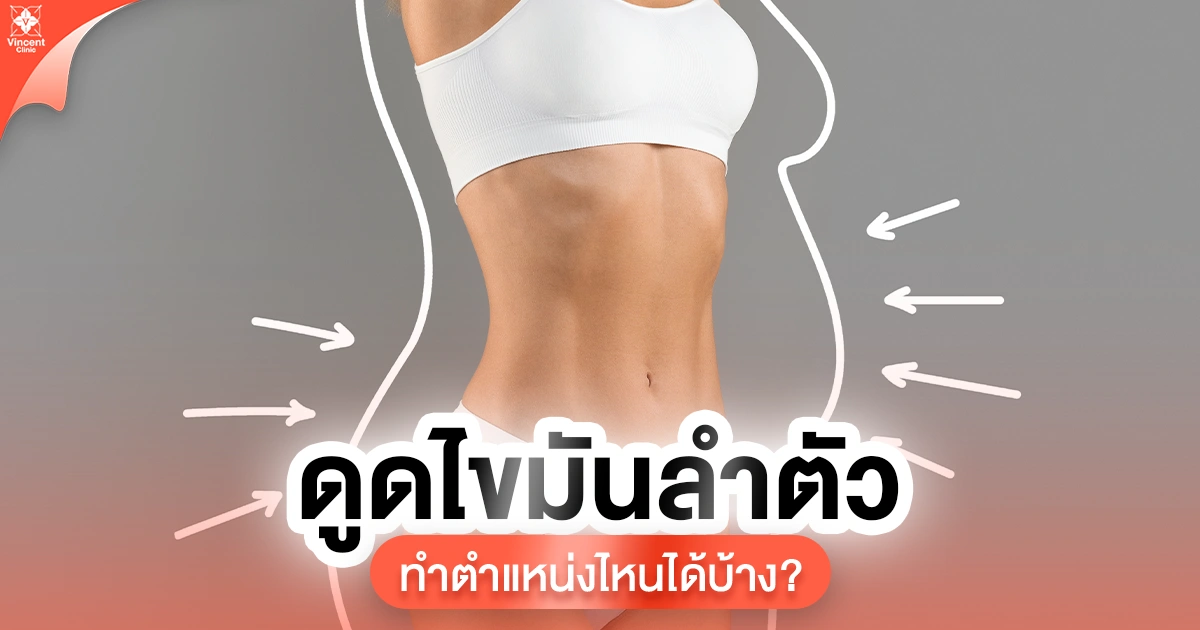 ดูดไขมันลำตัวทำตำแหน่งไหนได้บ้าง