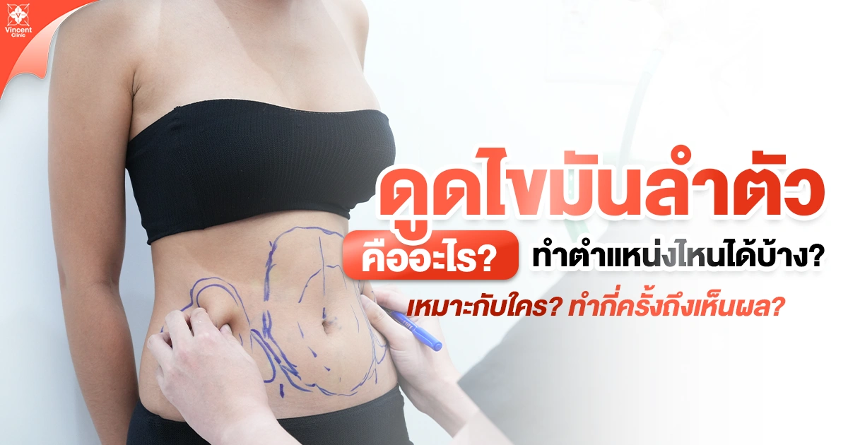 ดูดไขมันลำตัวคืออะไร
