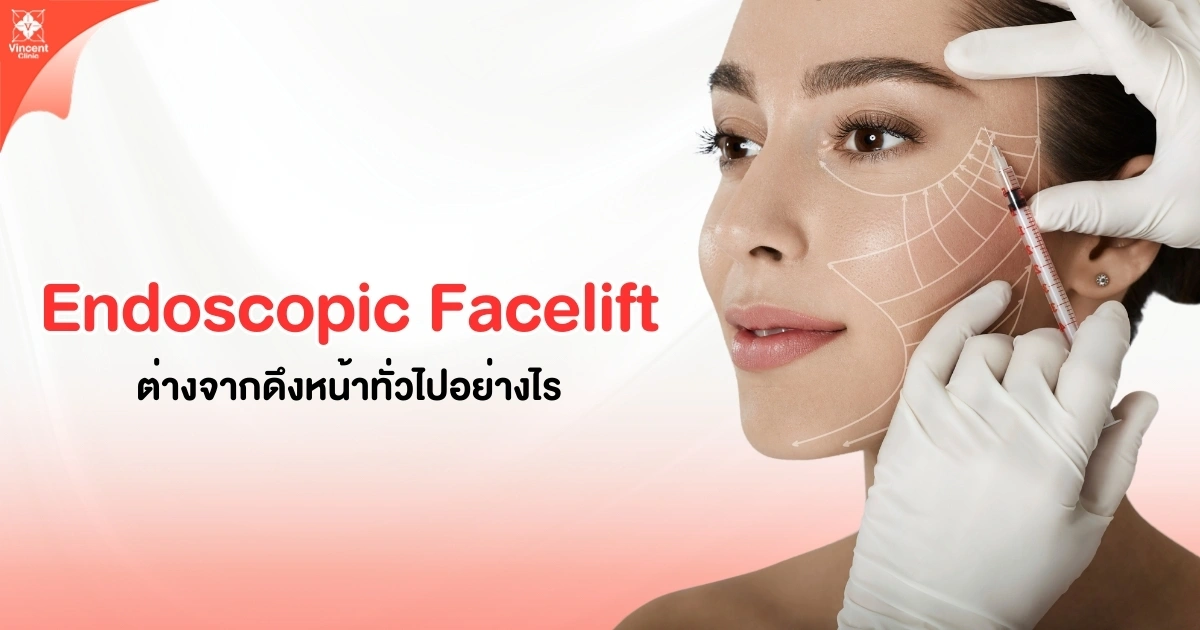 How is an endoscopic facelift different from a traditional facelift?
