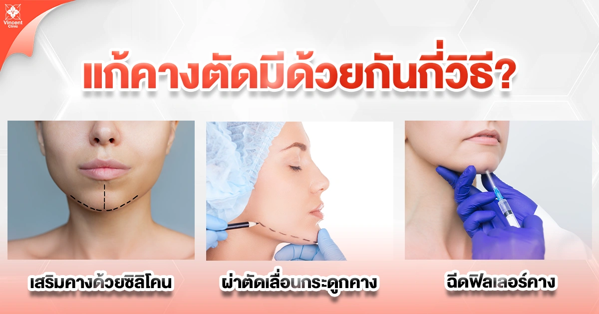 แก้คางตัดมีกี่วิธี