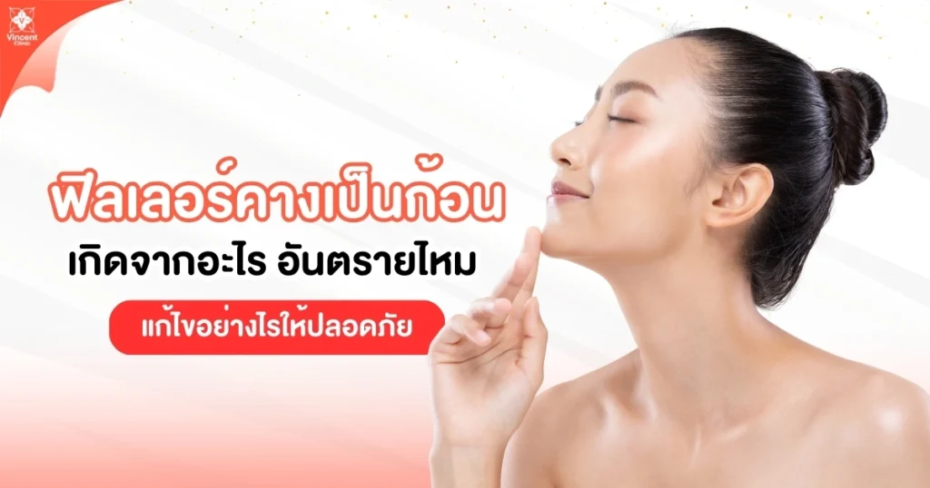 ฟิลเลอร์คางเป็นก้อนแก้ยังไง