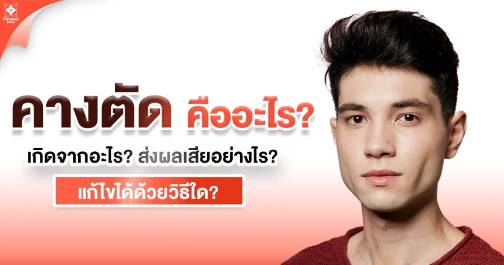 คางตัดคืออะไร