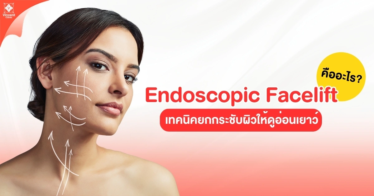 What is an endoscopic facelift?