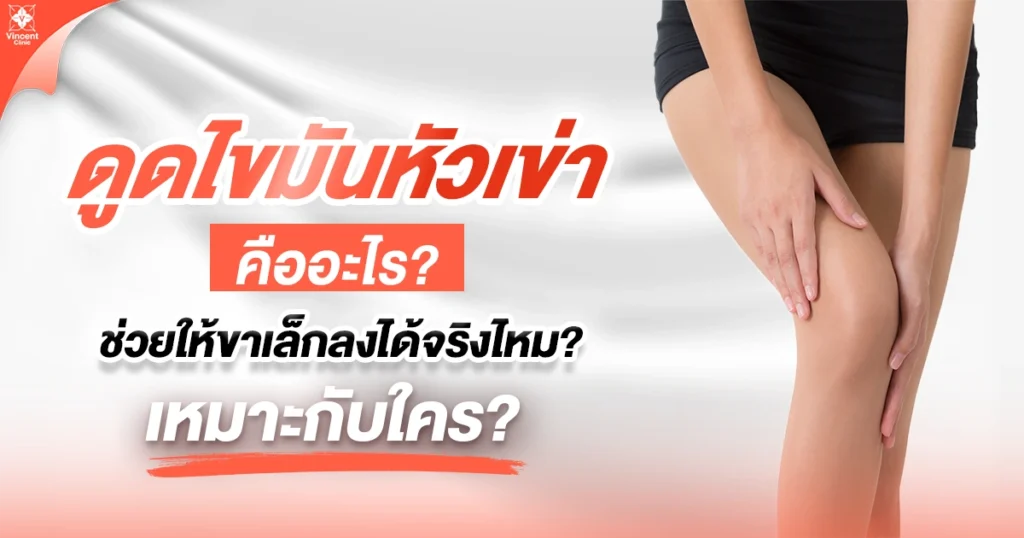 ดูดไขมันหัวเข่าคืออะไร