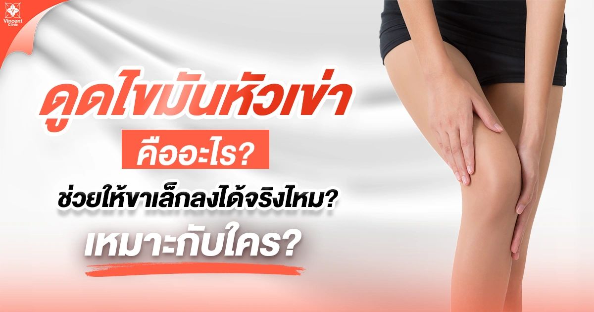 ดูดไขมันหัวเข่าคืออะไร