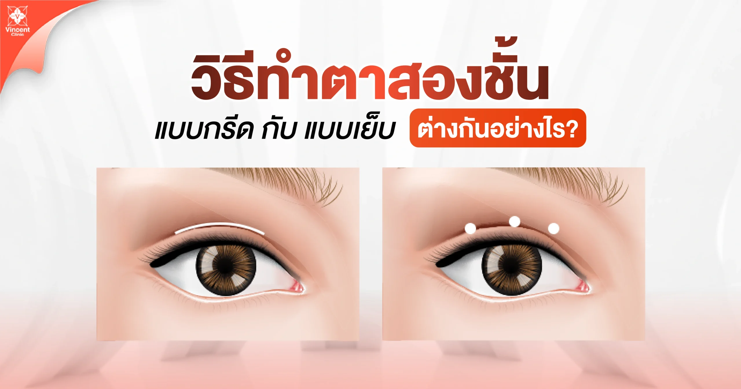 วิธีทำตาสองชั้นแบบกรีด กับ แบบเย็บ ต่างกันอย่างไร?