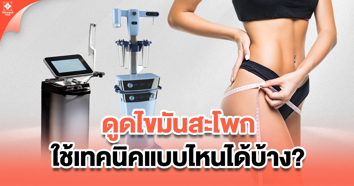 ดูดไขมันสะโพกใช้เทคนิคแบบไหนได้บ้าง
