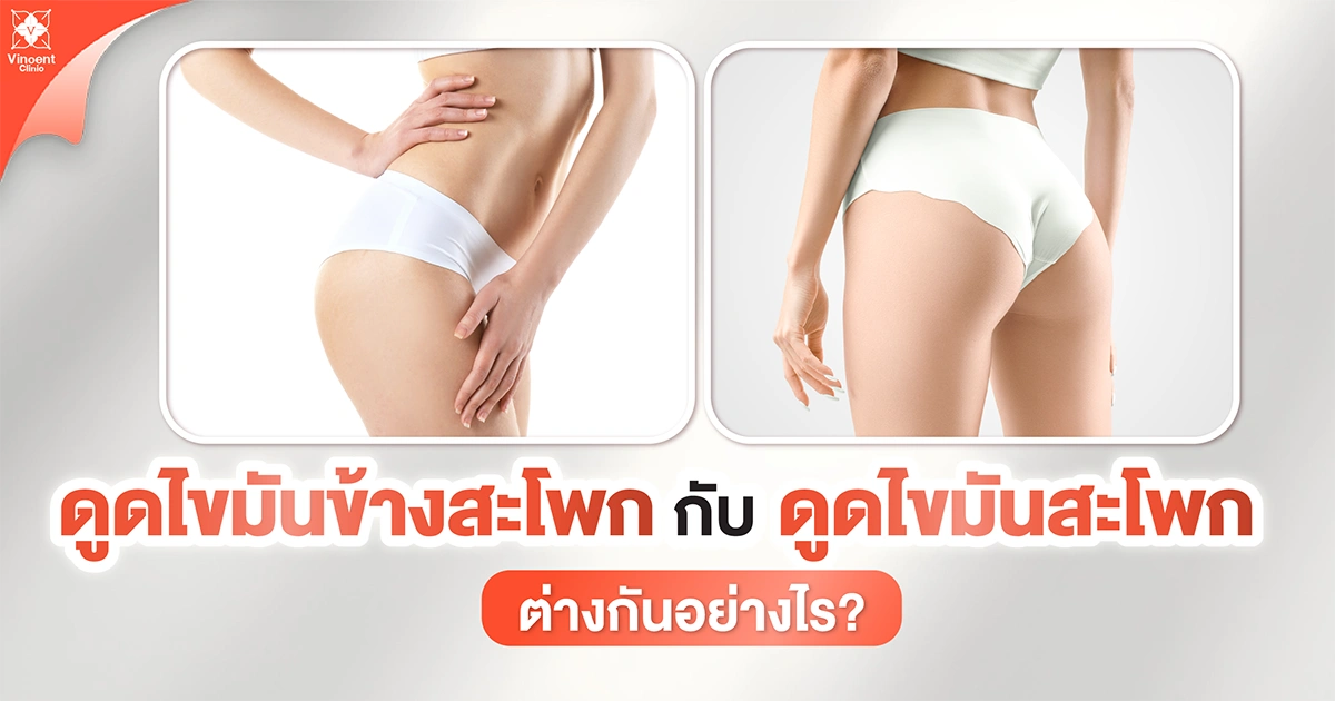 ดูดไขมันข้างสะโพกกับดูดไขมันสะโพกต่างกันยังไง