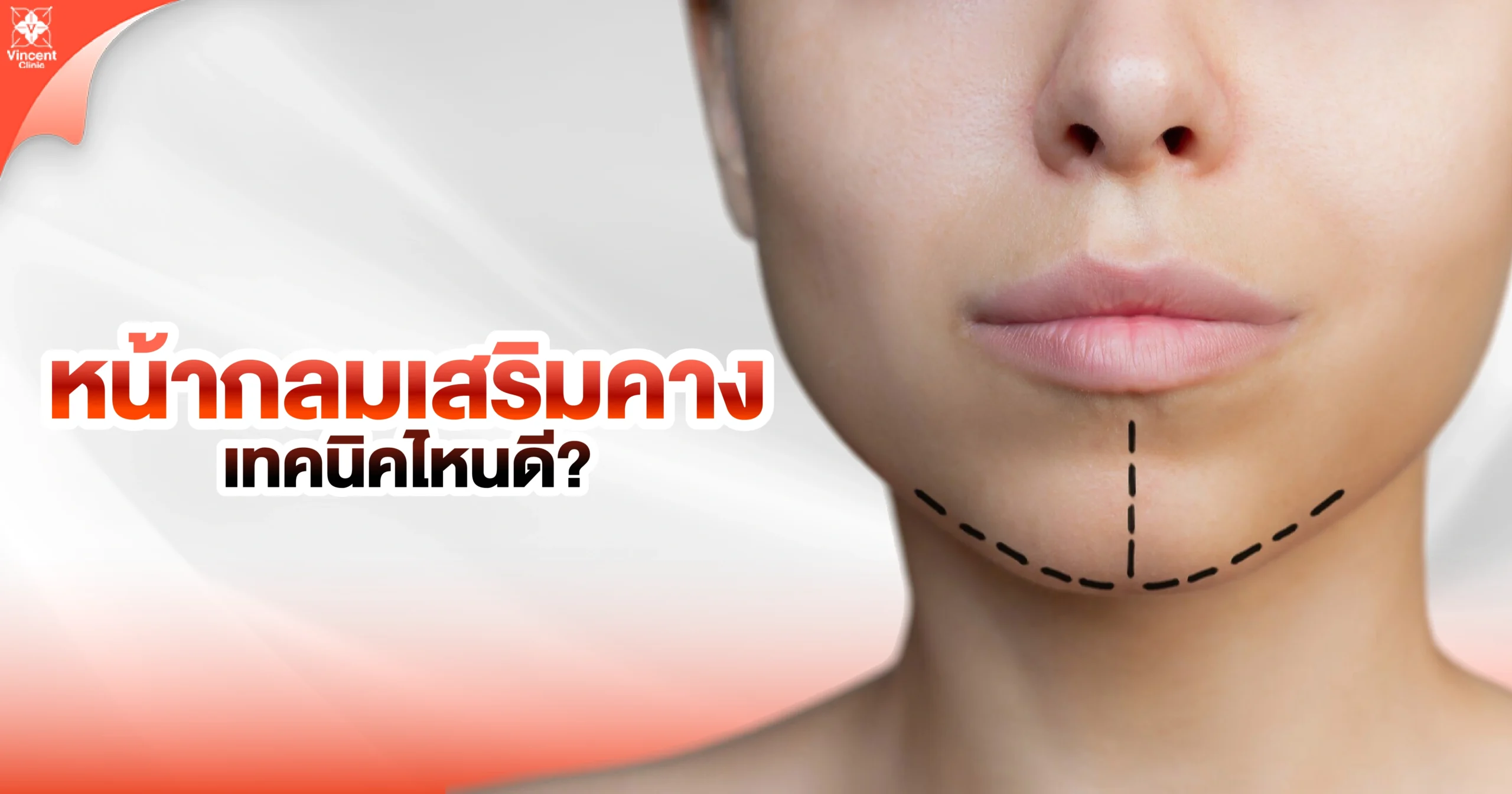 หน้ากลมเสริมคางเทคนิคไหน