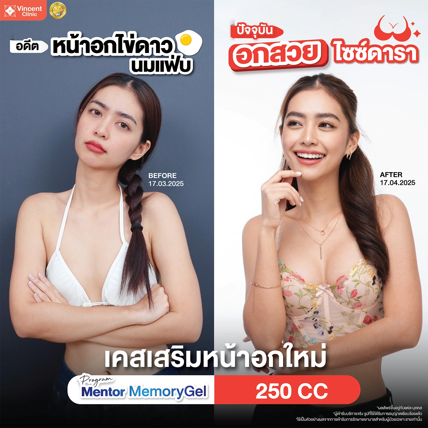 review breast