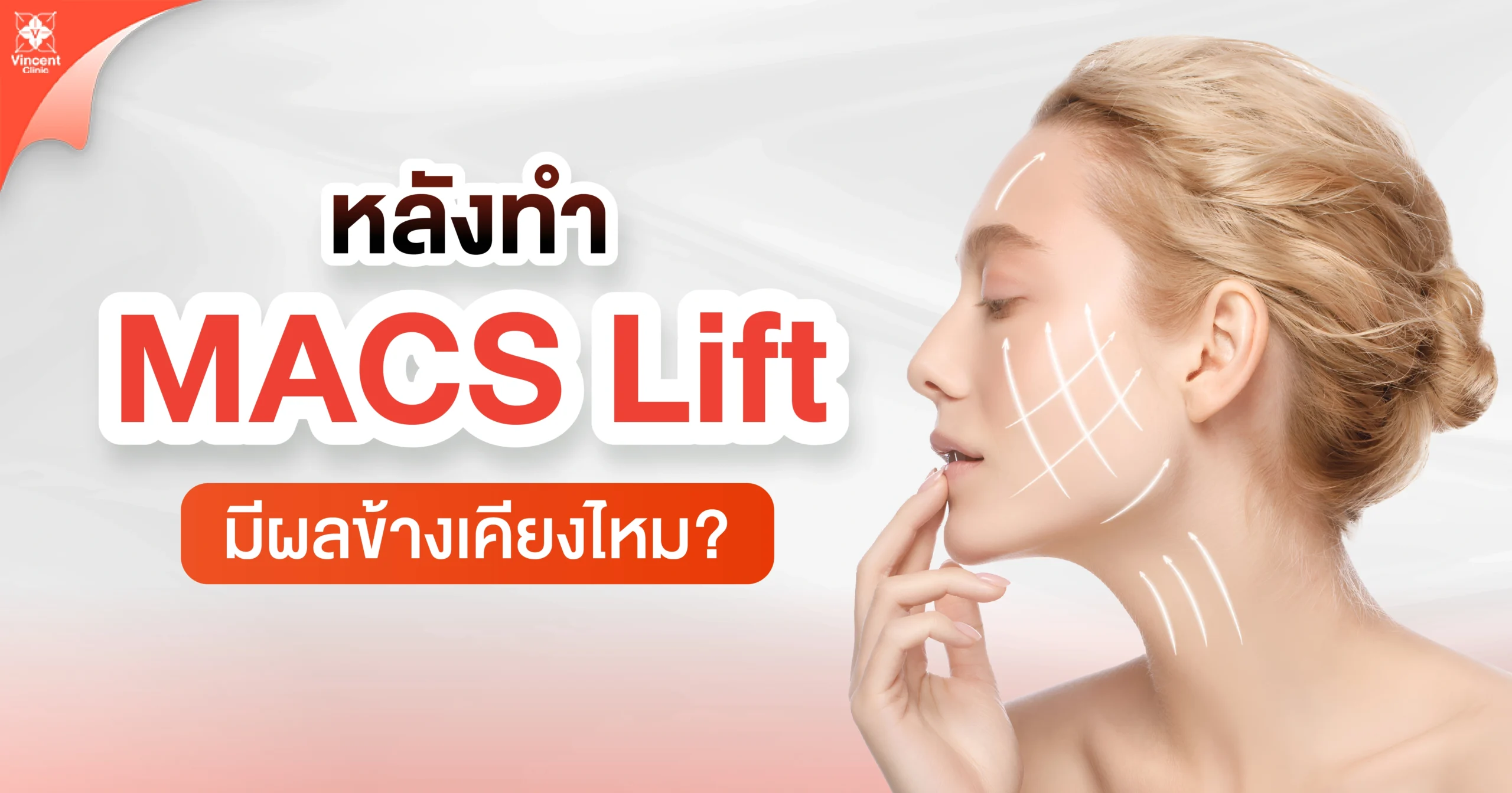 หลังทำ macs lift มีผลข้างเคียงไหม หลังทำ macs lift มีผลข้างเคียงไหม
