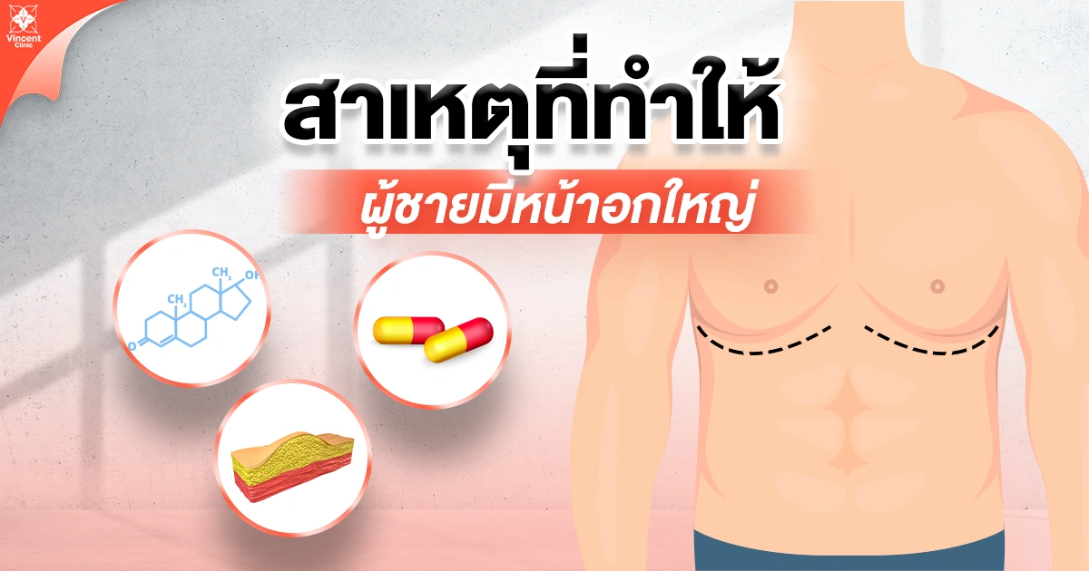 สาเหตุที่ทำให้ผู้ชายมีหน้าอกใหญ่